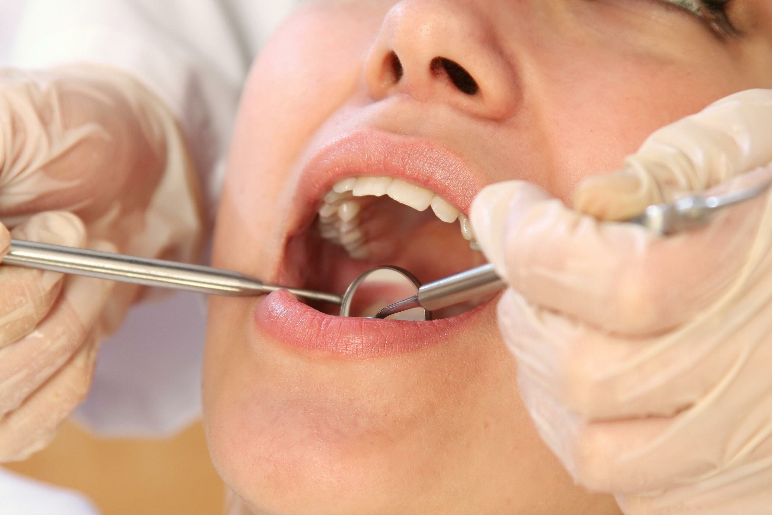 This is a thumbnail image of blog The Importance of Regular Dental Check-ups